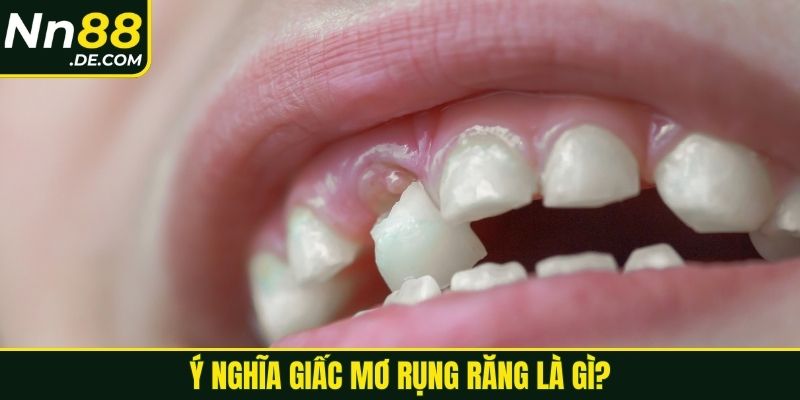 Ý nghĩa giấc mơ rụng răng là gì?